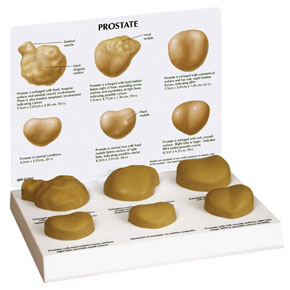 Prostate - Anatomical Model
