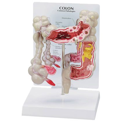 Colon - Budget Anatomical Model
