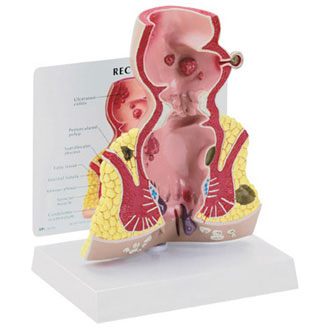 Rectum - Budget Anatomical Model