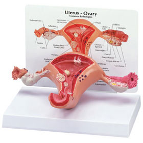 Uterus & Ovary - Budget Anatomical Model