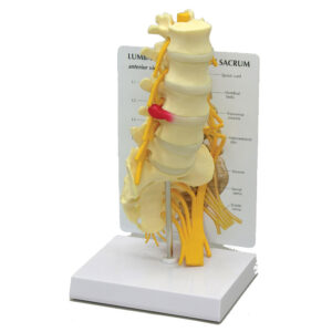 Lumbar Vertebrae & Sacrum - Budget Anatomical Model