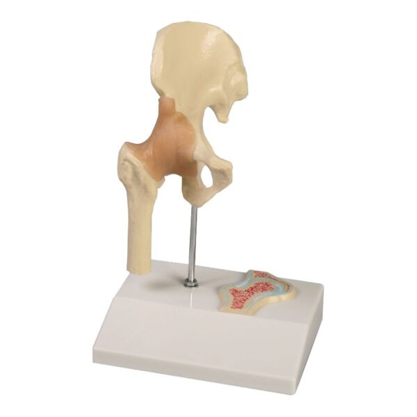 Half Life Size Hip Joint with Cross Section - Anatomical Model