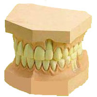 Upper & Lower Teeth Anatomical Model