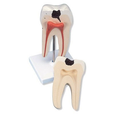 Molar Tooth Anatomical Model - High Detail