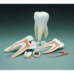 Tooth Decay Simulator Anatomical Model