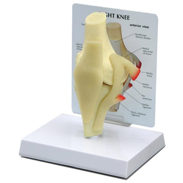 Basic Knee - Budget Anatomical Model