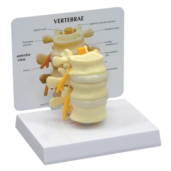 Basic Vertebrae - Budget Anatomical Model
