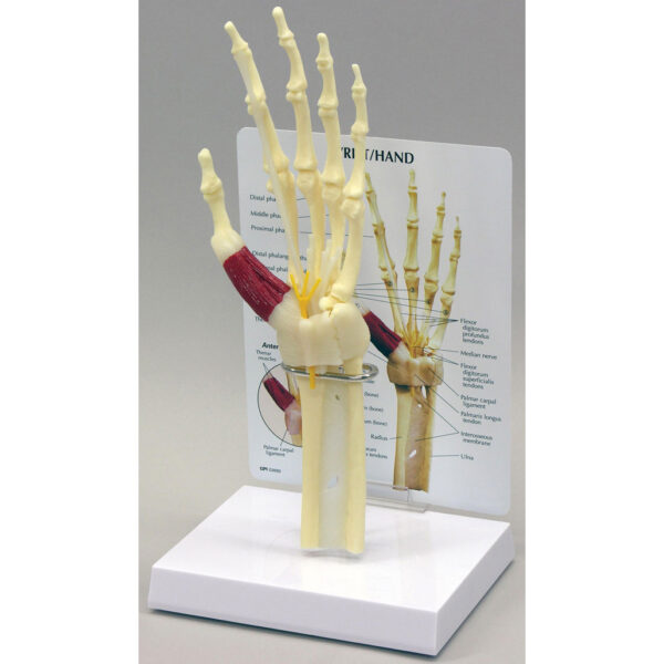 Hand Wrist Carpal Tunnel Syndrome - Anatomical Model