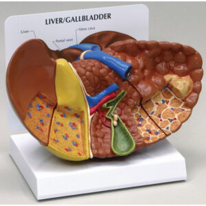 Liver Cancer - Anatomical Model