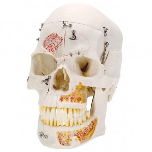 PRECIPETTE Human Head Skull Model丨Life Size Medical Quality Adult Head Model with Removable Skull Cap & Movable Jaw for Human Anatomy Study and Decoration 