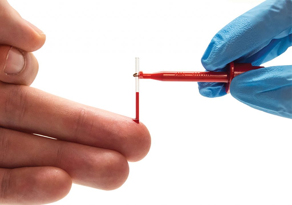 Blood lactate testing using EKF Diagnostics blood analyser fingerprick test. 